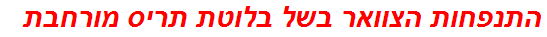 התנפחות הצוואר בשל בלוטת תריס מורחבת