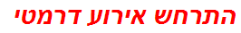 התרחש אירוע דרמטי