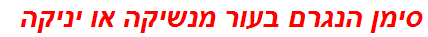 סימן הנגרם בעור מנשיקה או יניקה